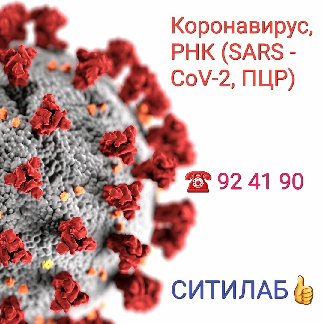 Sars-cov-2 картинка. Рнк sars. Sars covid 2 строение. Антигена вируса sars-cov-2. Структура sars-cov-2.